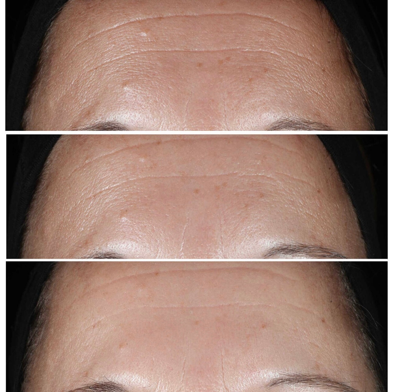 Smart Clinical Repair™ Wrinkle Correcting Serum