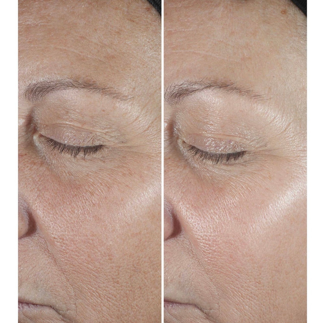 Smart Clinical Repair™ Wrinkle Correcting Serum