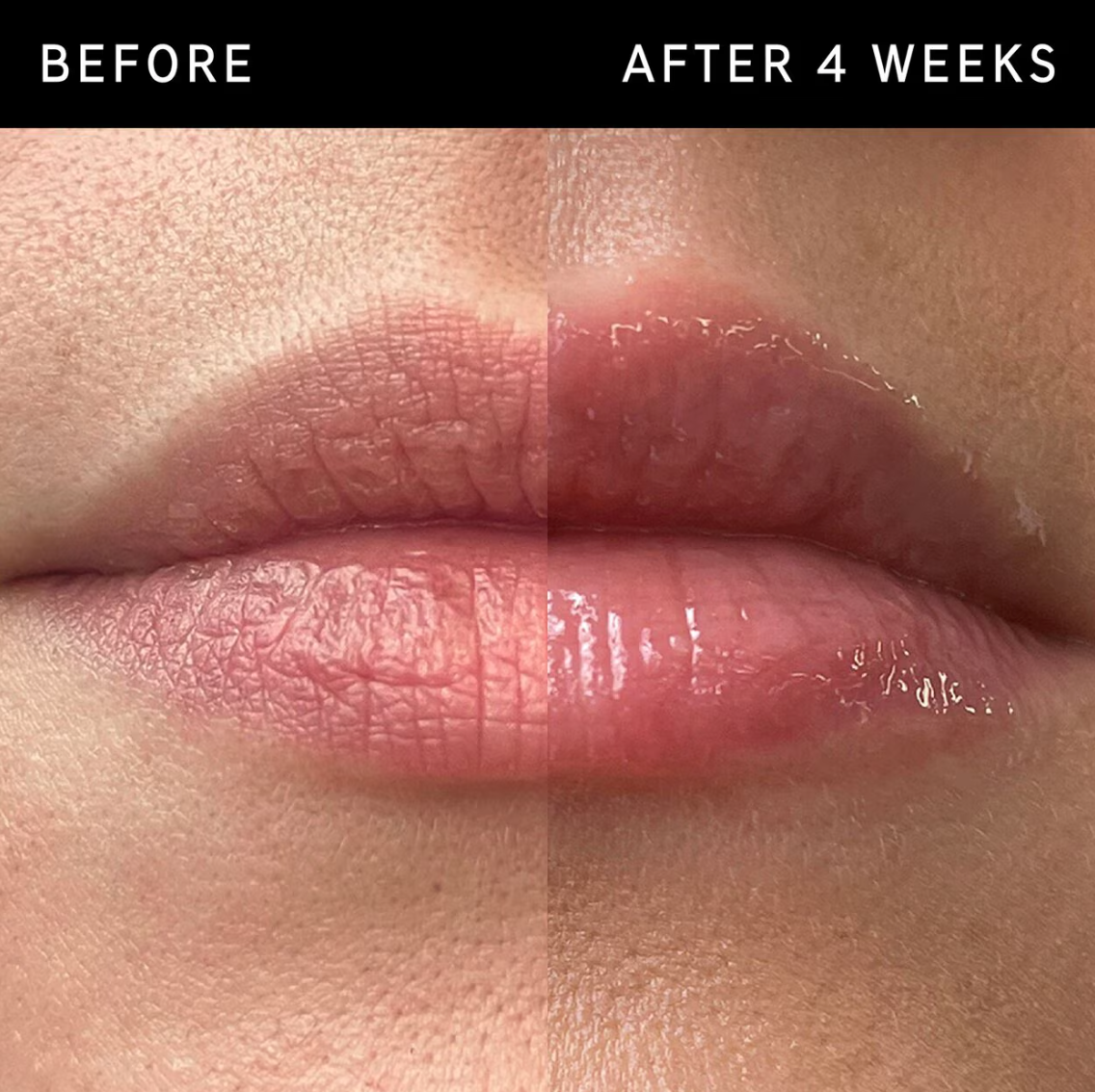 Clear Tripeptide Plumping Lip Balm, 10ml